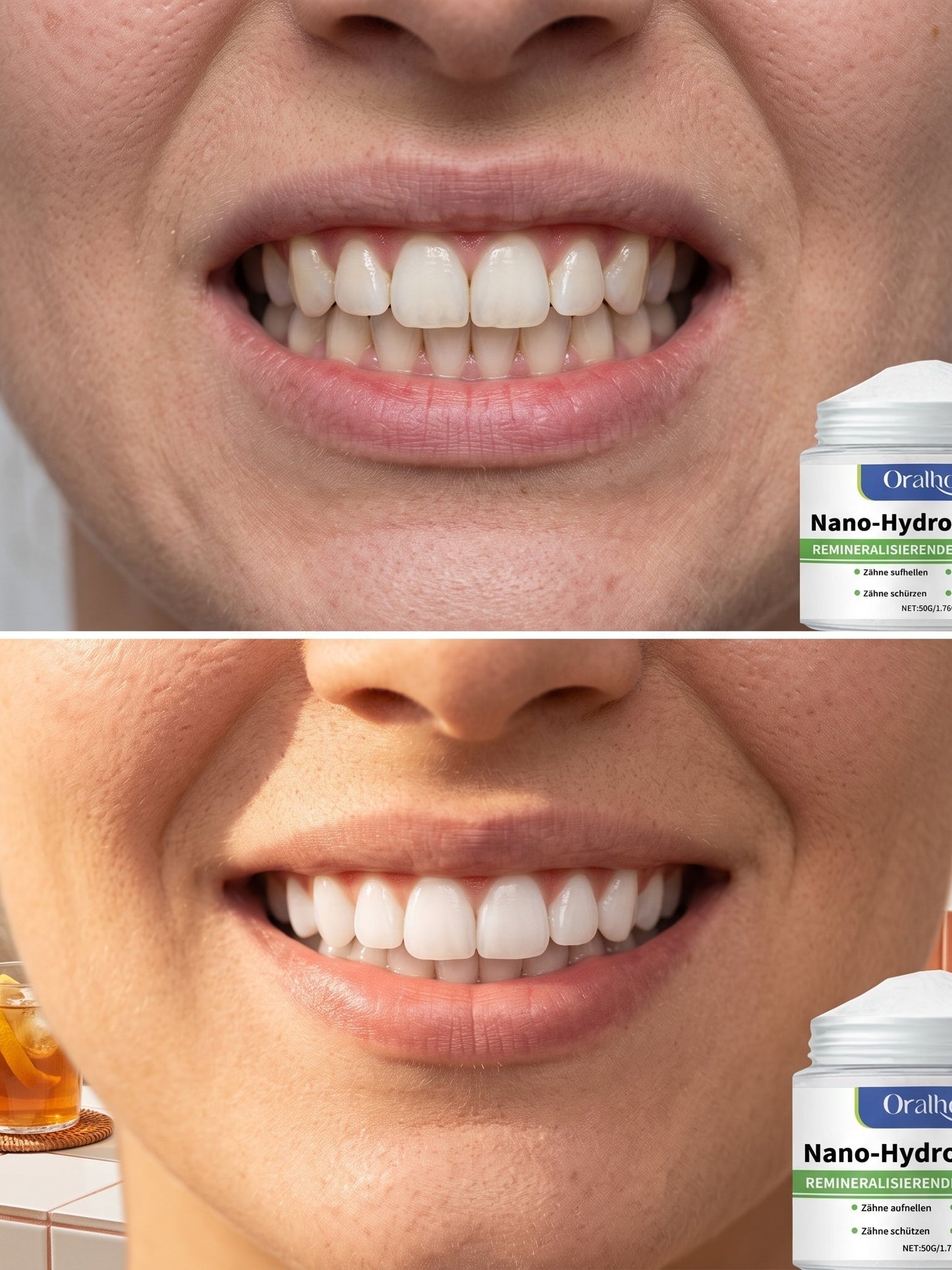 𝓑𝓵𝓪𝓷𝓬𝓱𝓲𝓼𝓼𝓮𝔃 et renforcez votre sourire